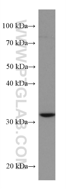Western Blot (WB) analysis of HeLa cells using SIRT5 Monoclonal antibody (67257-1-Ig)