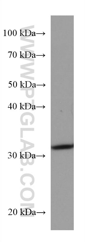 Western Blot (WB) analysis of L02 cells using SIRT5 Monoclonal antibody (67257-1-Ig)