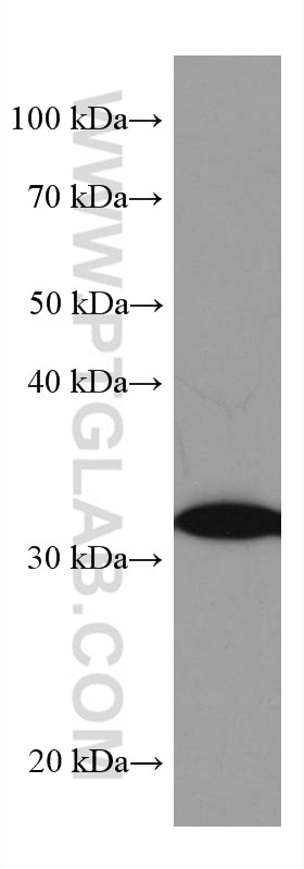 Western Blot (WB) analysis of LNCaP cells using SIRT5 Monoclonal antibody (67257-1-Ig)