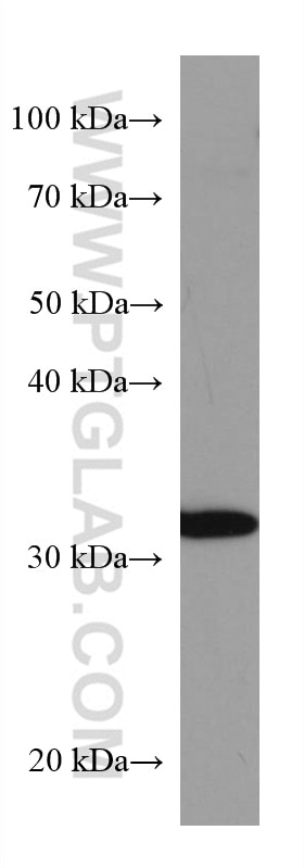 Western Blot (WB) analysis of K-562 cells using SIRT5 Monoclonal antibody (67257-1-Ig)