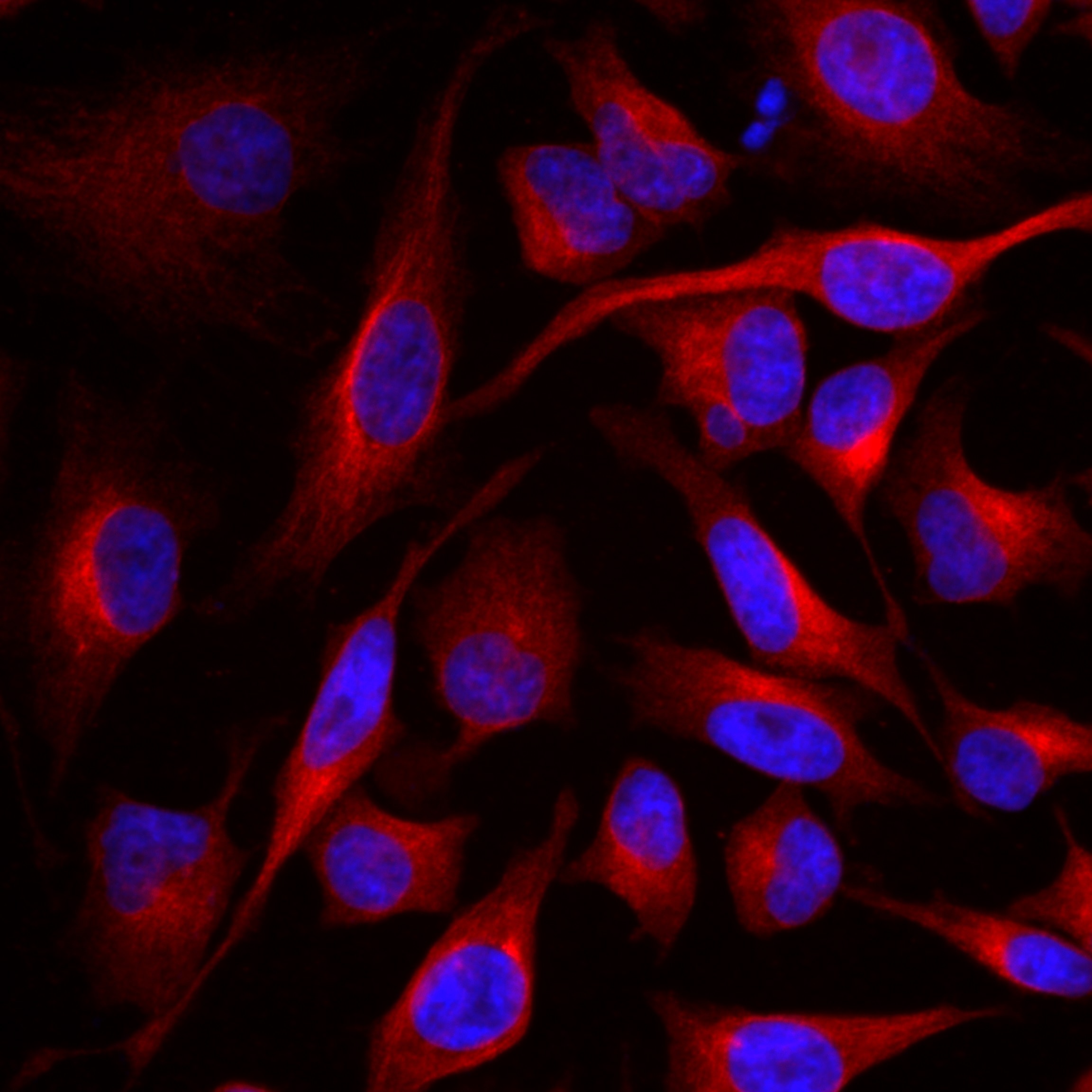 Immunofluorescence (IF) / fluorescent staining of HeLa cells using SIRT5 Recombinant antibody (82246-1-RR)
