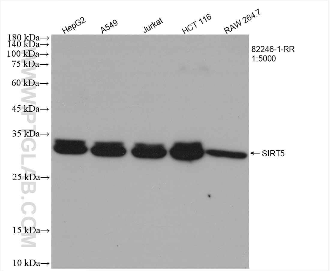 Western Blot (WB) analysis of various lysates using SIRT5 Recombinant antibody (82246-1-RR)