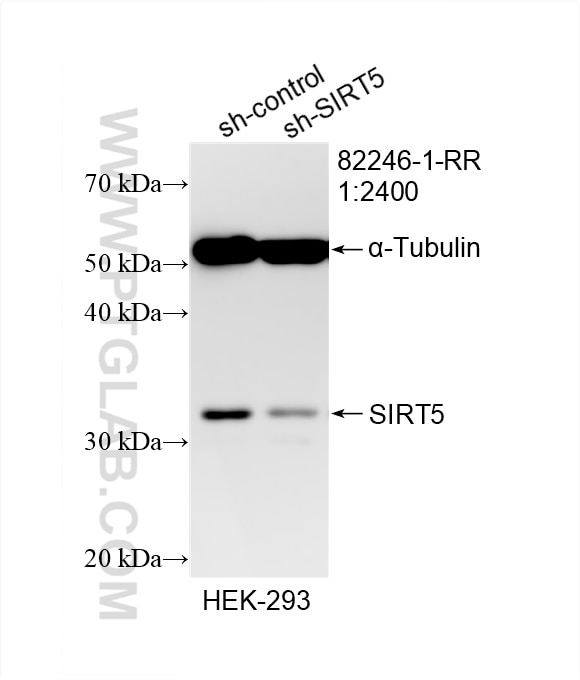 Western Blot (WB) analysis of HEK-293 cells using SIRT5 Recombinant antibody (82246-1-RR)