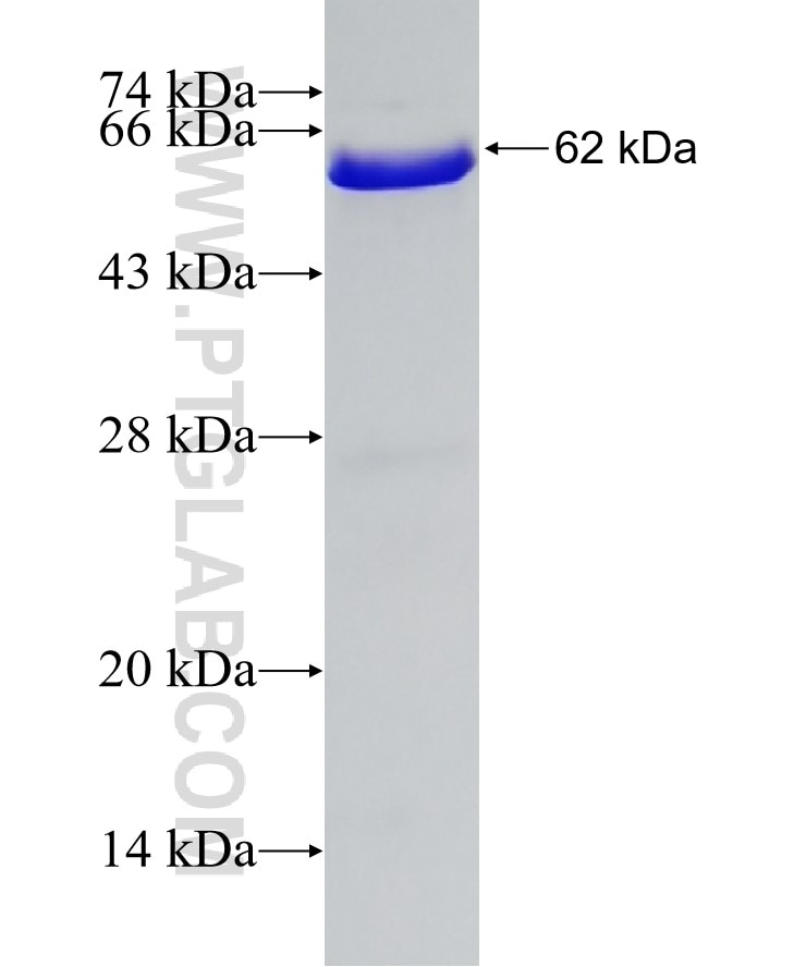 SIRT5 fusion protein Ag7195 SDS-PAGE