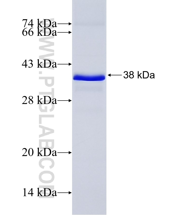 SIRT5 fusion protein Ag7743 SDS-PAGE