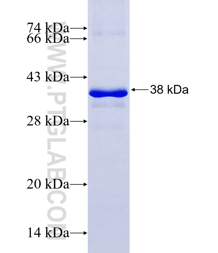 SIRT5 fusion protein Ag7743 SDS-PAGE