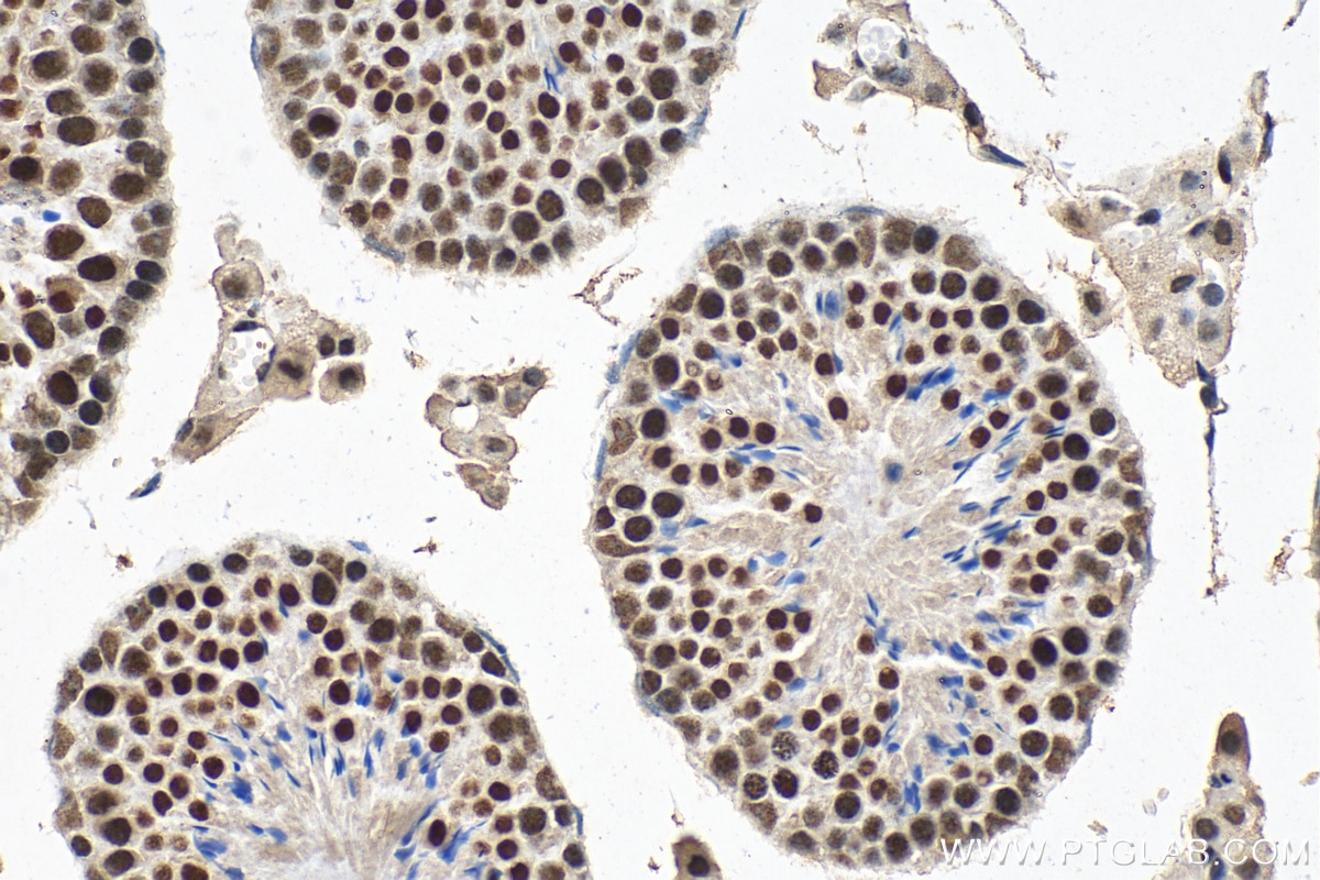 IHC staining of mouse testis using 13572-1-AP