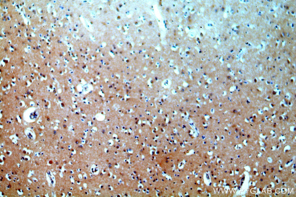 Immunohistochemistry (IHC) staining of human brain tissue using SIRT6 Polyclonal antibody (13572-1-AP)