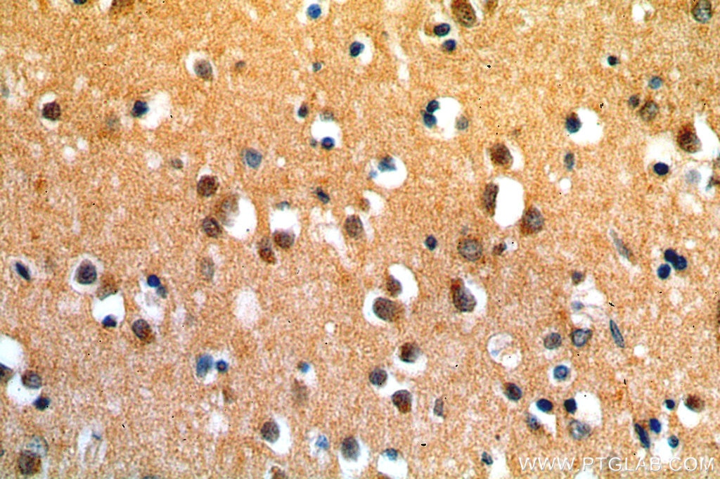 Immunohistochemistry (IHC) staining of human brain tissue using SIRT6 Polyclonal antibody (13572-1-AP)