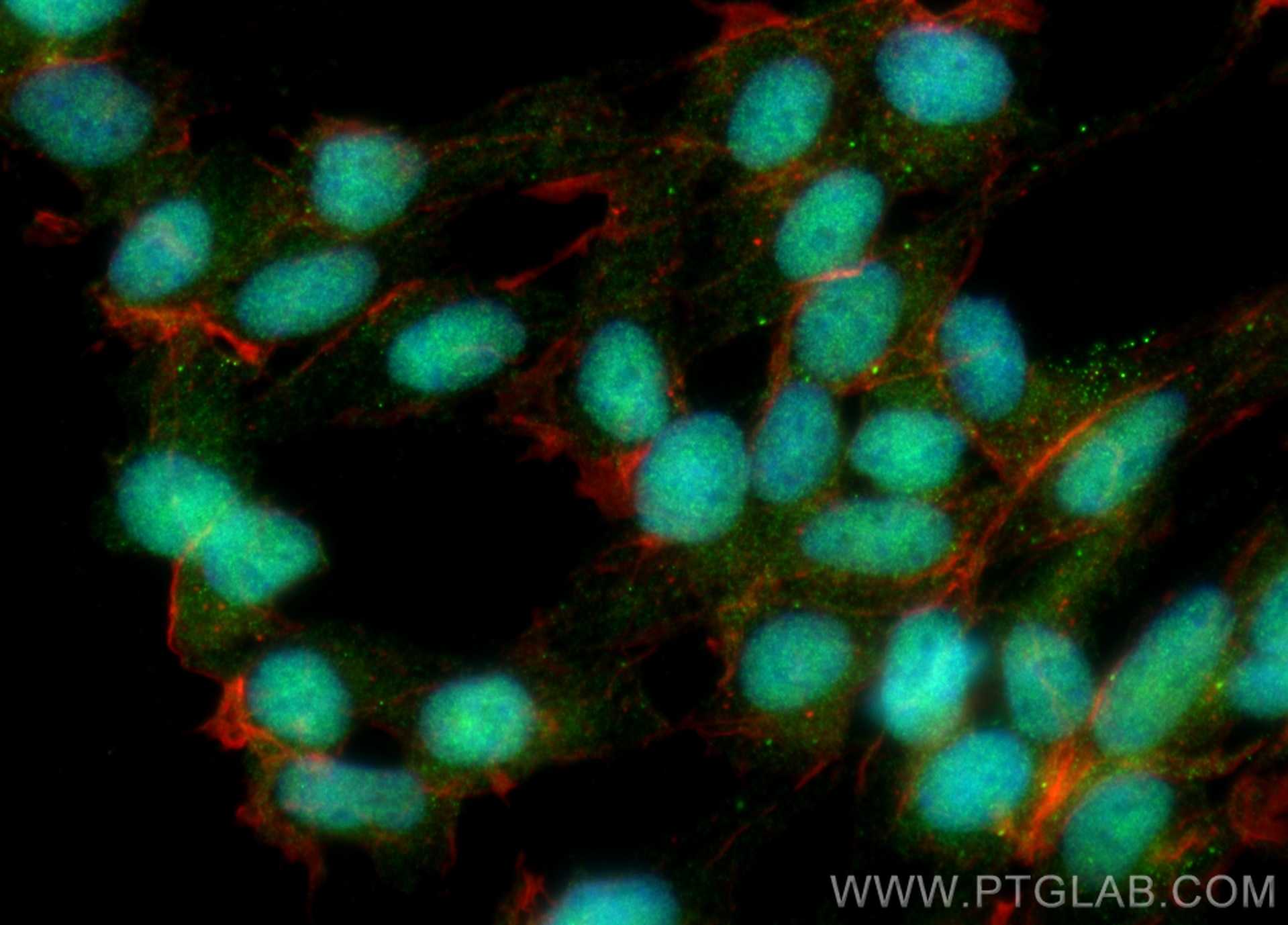 Immunofluorescence (IF) / fluorescent staining of SH-SY5Y cells using SIRT6 Polyclonal antibody (28677-1-AP)