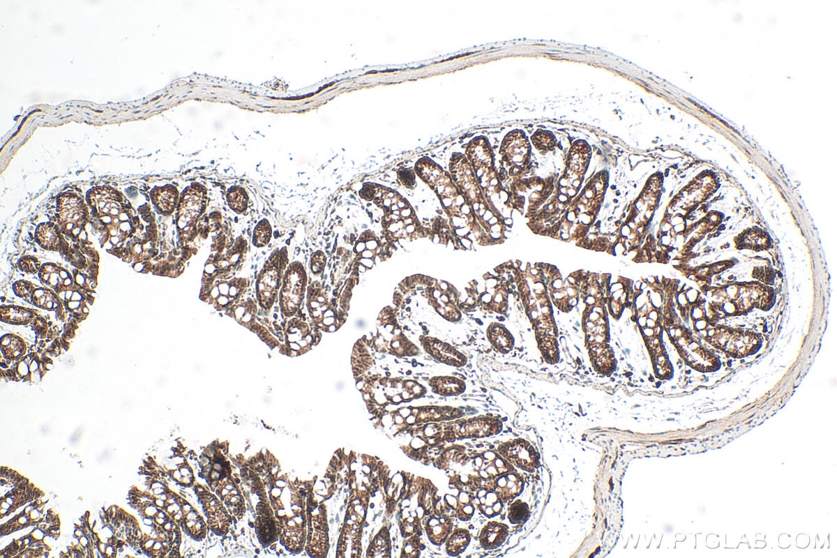 Immunohistochemistry (IHC) staining of mouse colon tissue using SIRT6 Polyclonal antibody (28677-1-AP)