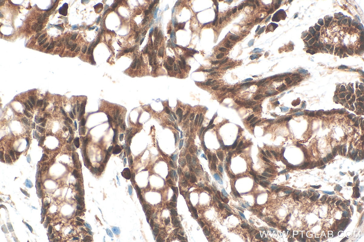 Immunohistochemistry (IHC) staining of mouse colon tissue using SIRT6 Polyclonal antibody (28677-1-AP)