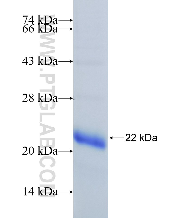SIRT6 fusion protein Ag29181 SDS-PAGE
