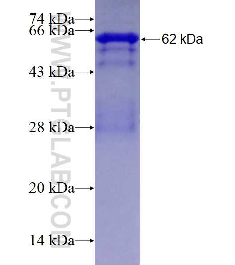 SIRT6 fusion protein Ag4469 SDS-PAGE