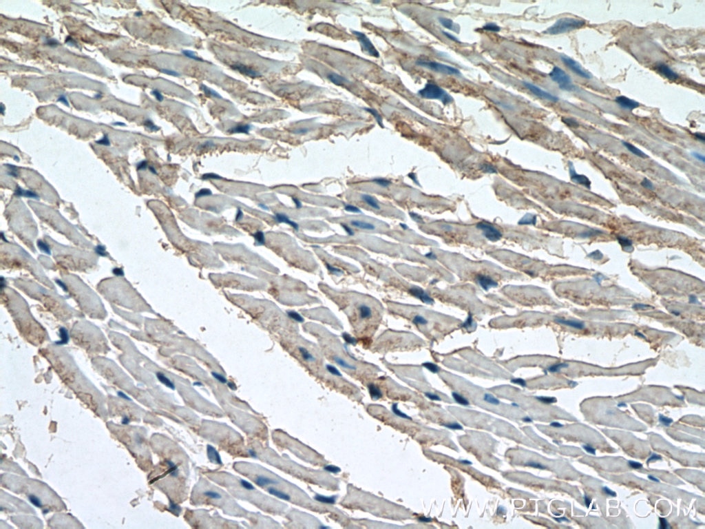 Immunohistochemistry (IHC) staining of mouse heart tissue using SIRT7 Polyclonal antibody (12994-1-AP)