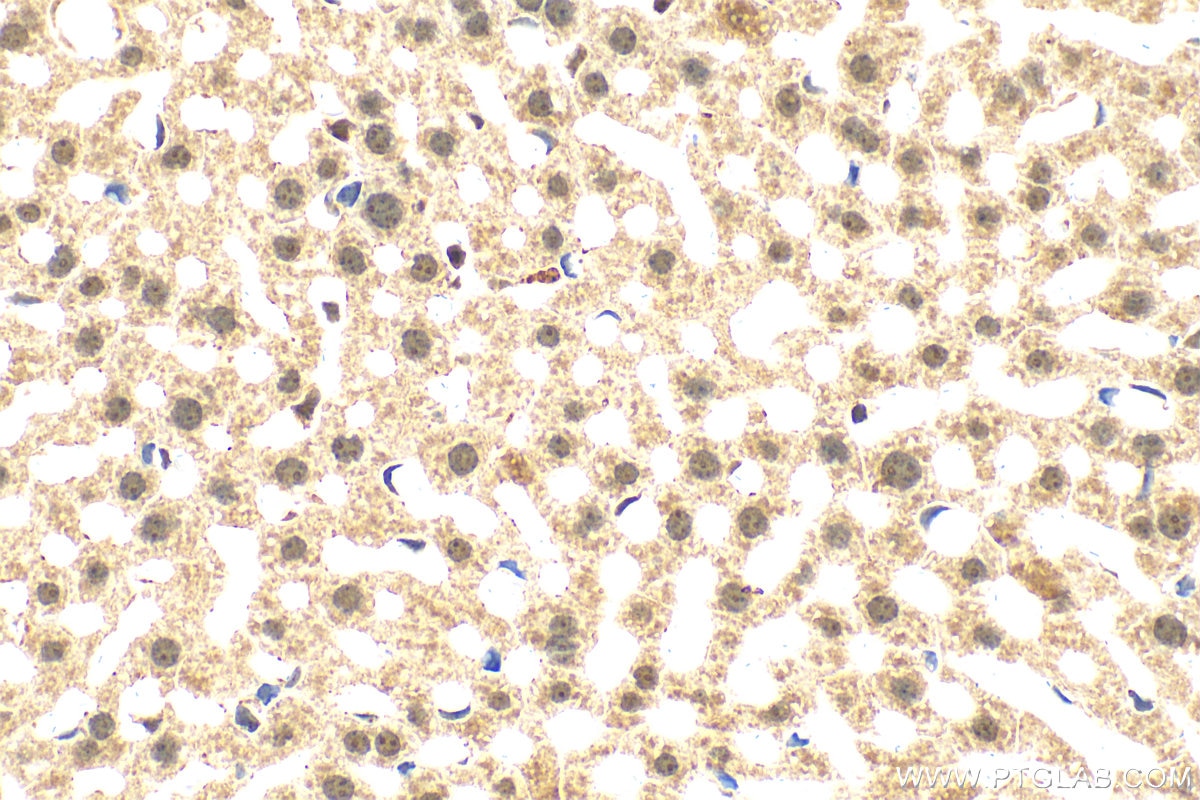 Immunohistochemistry (IHC) staining of mouse liver tissue using SIRT7 Polyclonal antibody (12994-1-AP)