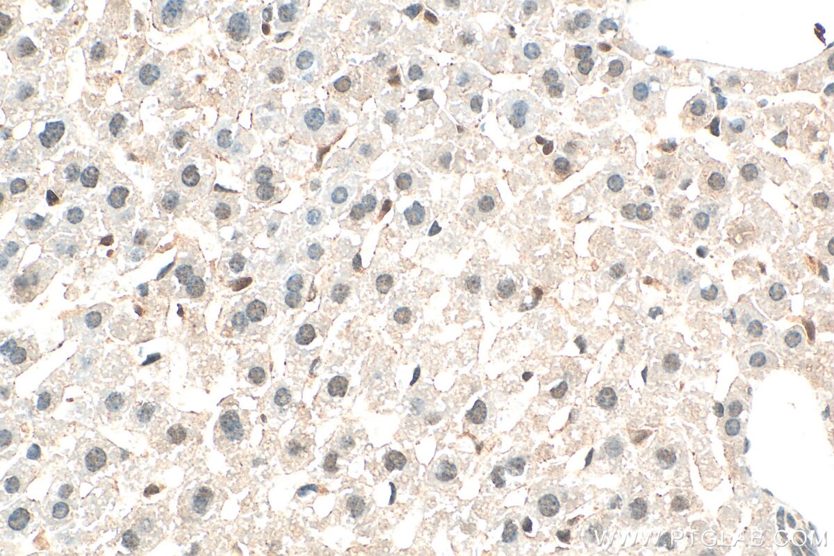 Immunohistochemistry (IHC) staining of mouse liver tissue using SIRT7 Polyclonal antibody (29729-1-AP)