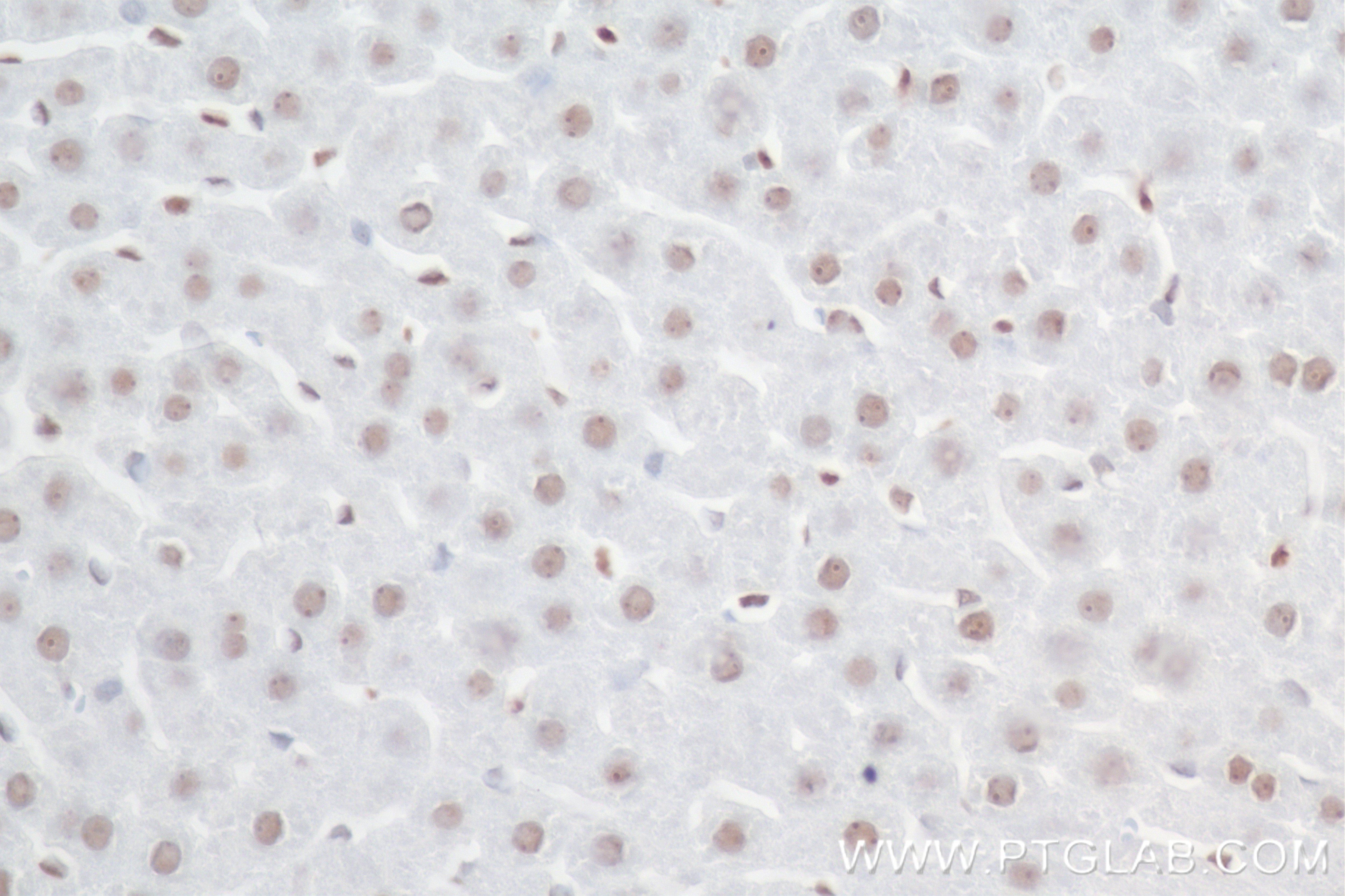 Immunohistochemistry (IHC) staining of rat liver tissue using SIRT7 Recombinant antibody (84805-4-RR)
