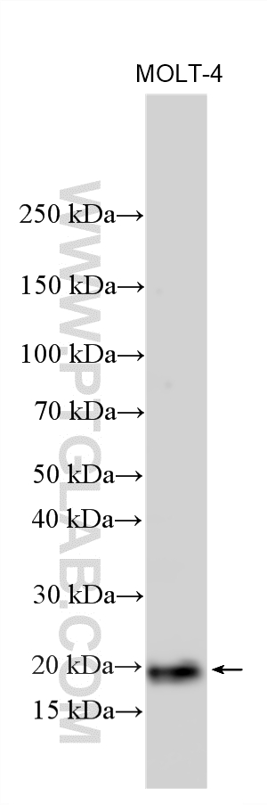 Western Blot (WB) analysis of various lysates using SIVA1 Polyclonal antibody (27119-1-AP)