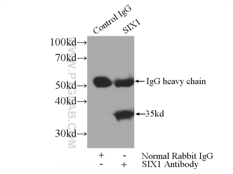 Immunoprecipitation (IP) experiment of HEK-293 cells using SIX1 Polyclonal antibody (10709-1-AP)