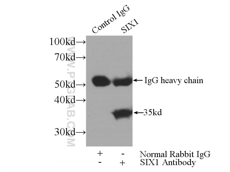 IP experiment of HEK-293 using 10709-1-AP