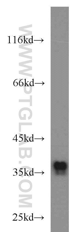 Western Blot (WB) analysis of A2780 cells using SIX1 Polyclonal antibody (10709-1-AP)