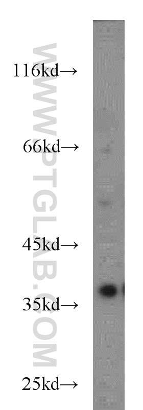 Western Blot (WB) analysis of SKOV-3 cells using SIX1 Polyclonal antibody (10709-1-AP)