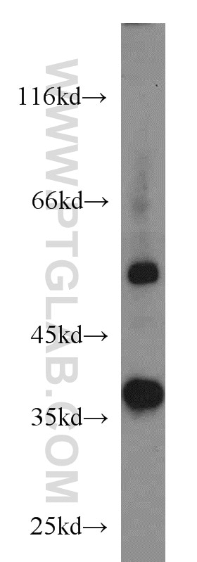 Western Blot (WB) analysis of SKOV-3 cells using SIX1 Polyclonal antibody (10709-1-AP)