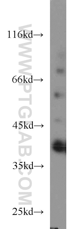 Western Blot (WB) analysis of HepG2 cells using SIX1 Polyclonal antibody (10709-1-AP)