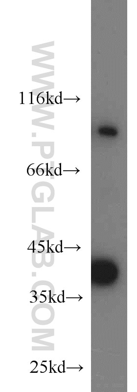 Western Blot (WB) analysis of HEK-293 cells using SIX1 Polyclonal antibody (10709-1-AP)