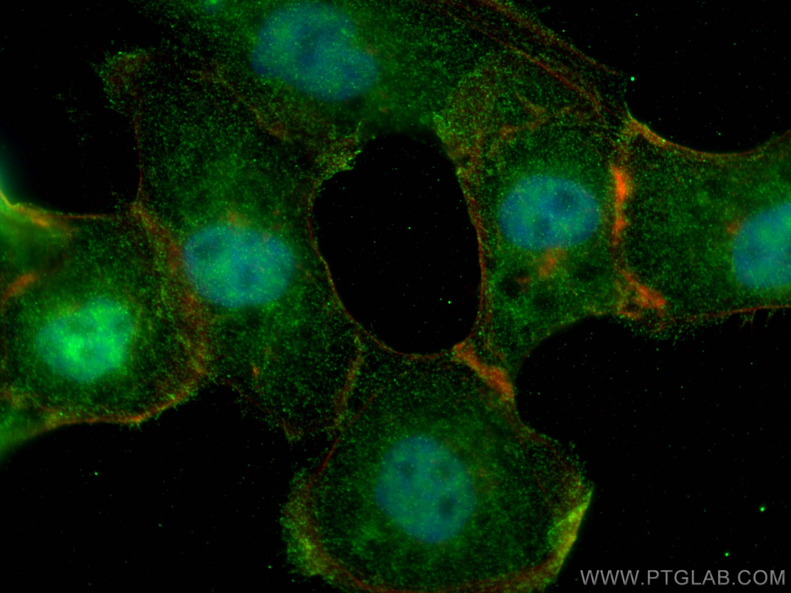 Immunofluorescence (IF) / fluorescent staining of A431 cells using SIX1 Monoclonal antibody (67741-1-Ig)