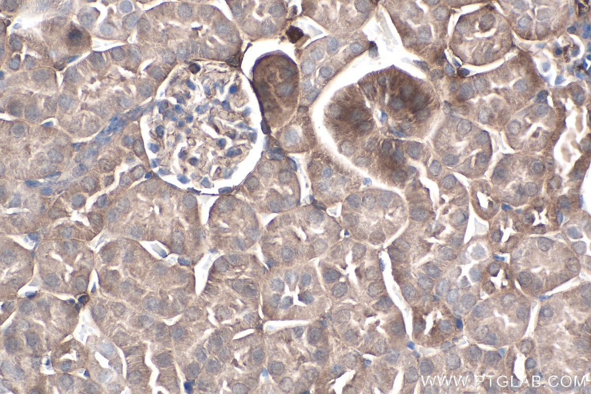 IHC staining of mouse kidney using 67741-1-Ig Immunohistochemistry (IHC) staining of mouse kidney tissue using SIX1 Monoclonal antibody (67741-1-Ig)
