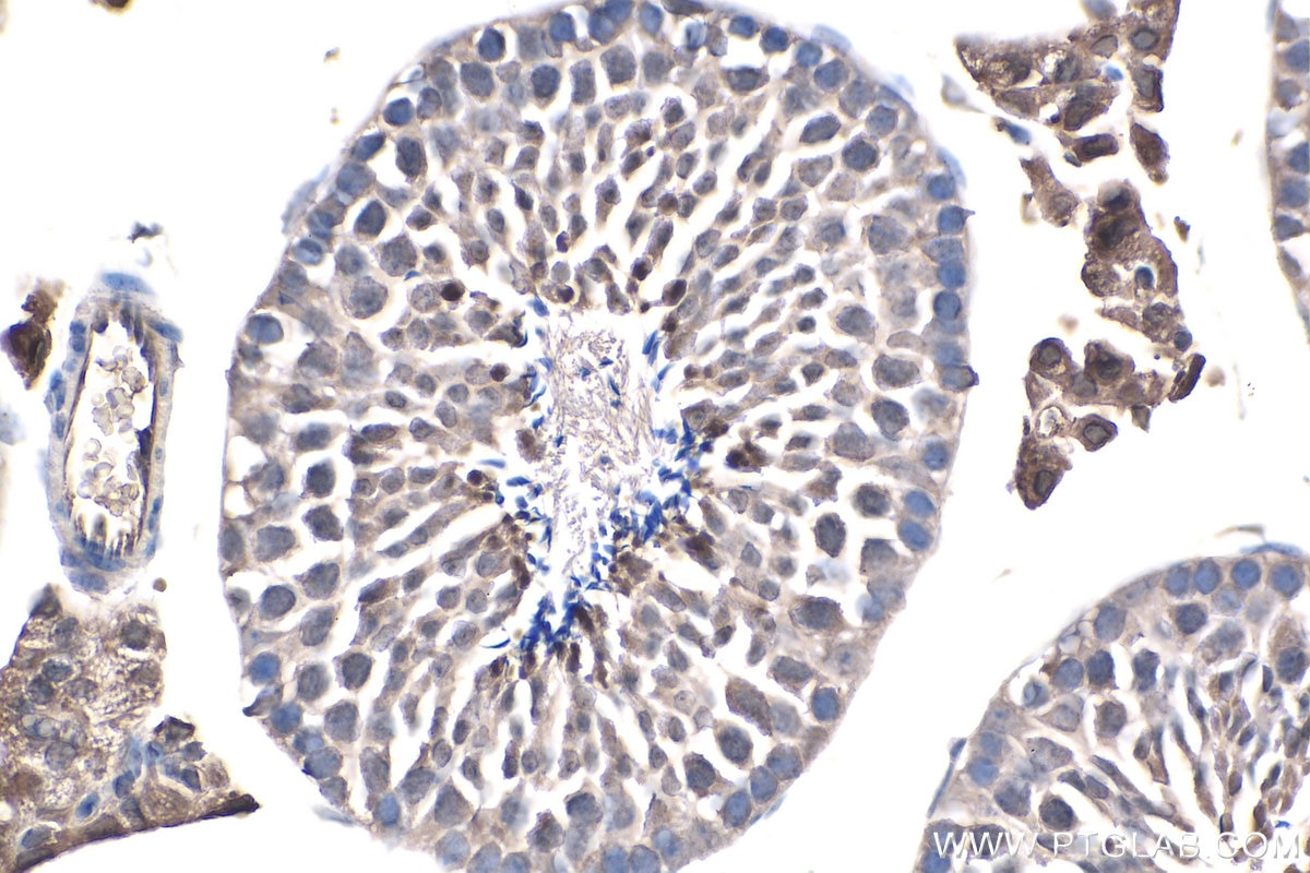 IHC staining of mouse testis using 67741-1-Ig Immunohistochemistry (IHC) staining of mouse testis tissue using SIX1 Monoclonal antibody (67741-1-Ig)