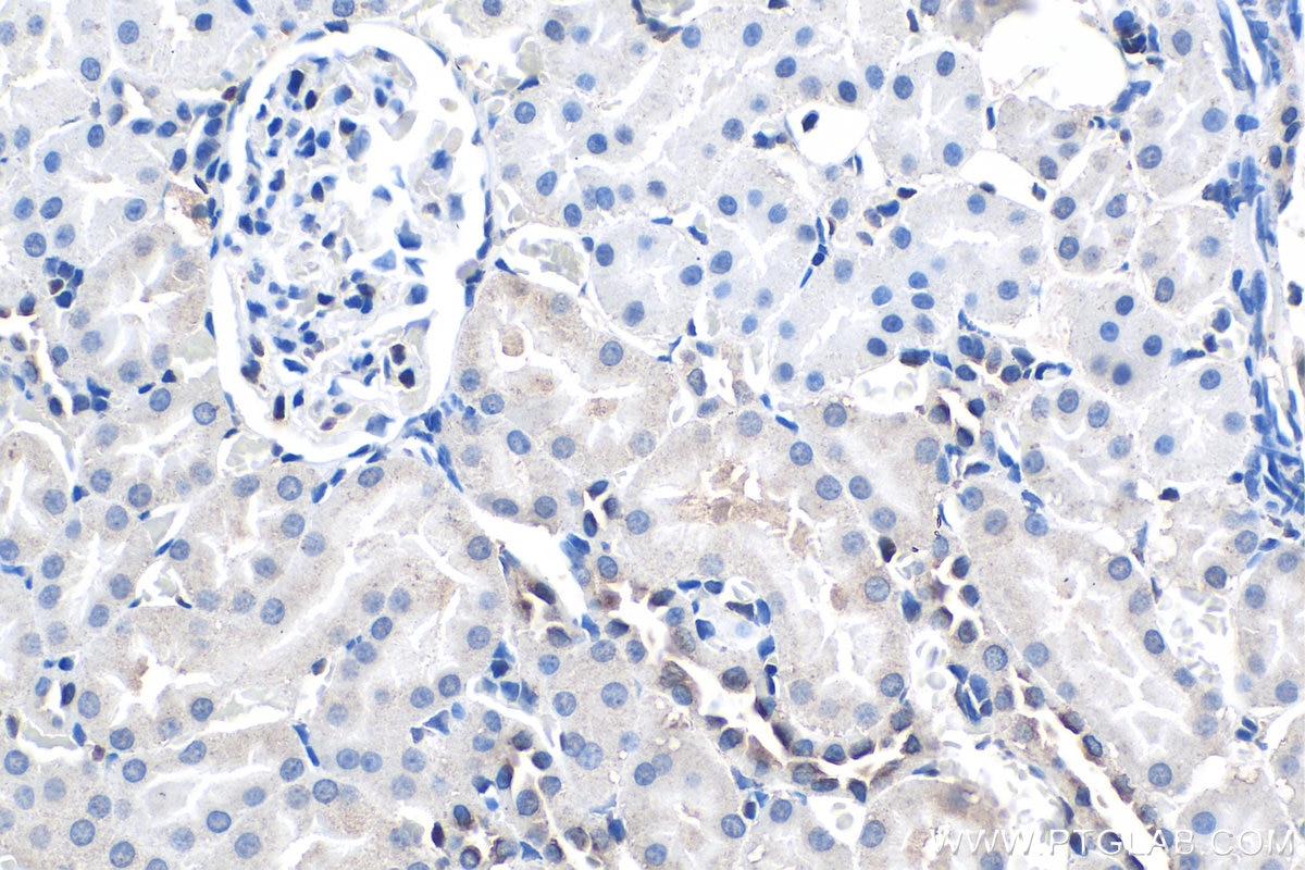 IHC staining of rat kidney using 67741-1-Ig Immunohistochemistry (IHC) staining of rat kidney tissue using SIX1 Monoclonal antibody (67741-1-Ig)