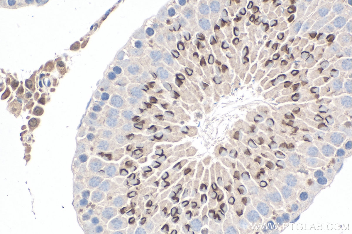 IHC staining of rat testis using 67741-1-Ig Immunohistochemistry (IHC) staining of rat testis tissue using SIX1 Monoclonal antibody (67741-1-Ig)
