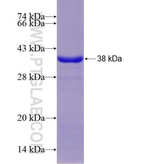 SIX1 fusion protein Ag28570 SDS-PAGE