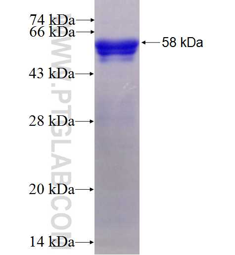 SIX1 fusion protein Ag1044 SDS-PAGE