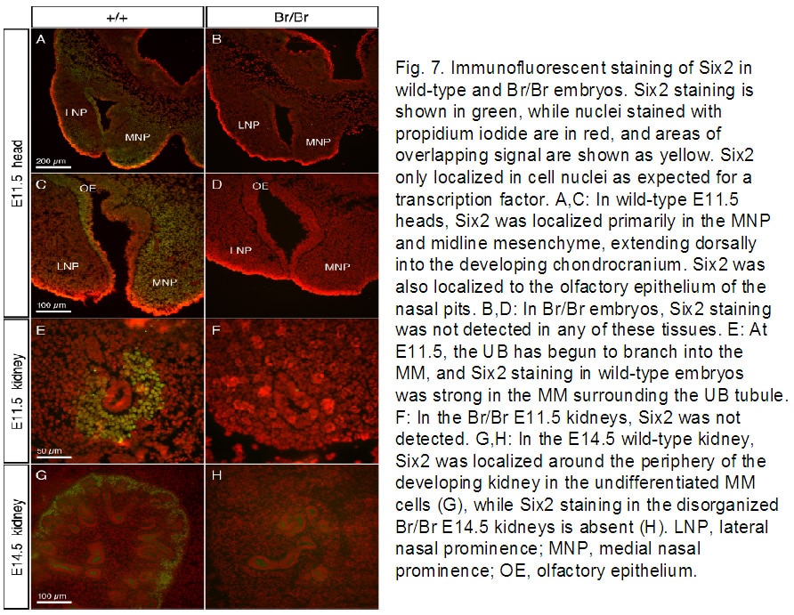 IF Staining of heritable frontonasal dysplasia and renal hypoplas using 11562-1-AP