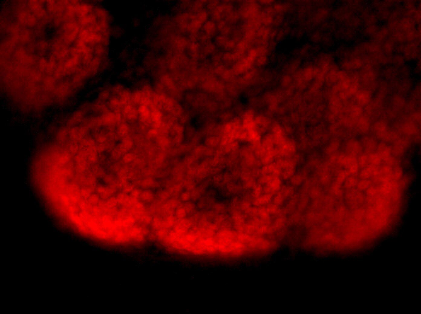 Immunofluorescence (IF) / fluorescent staining of mouse embryonic kidney using SIX2 Polyclonal antibody (11562-1-AP)