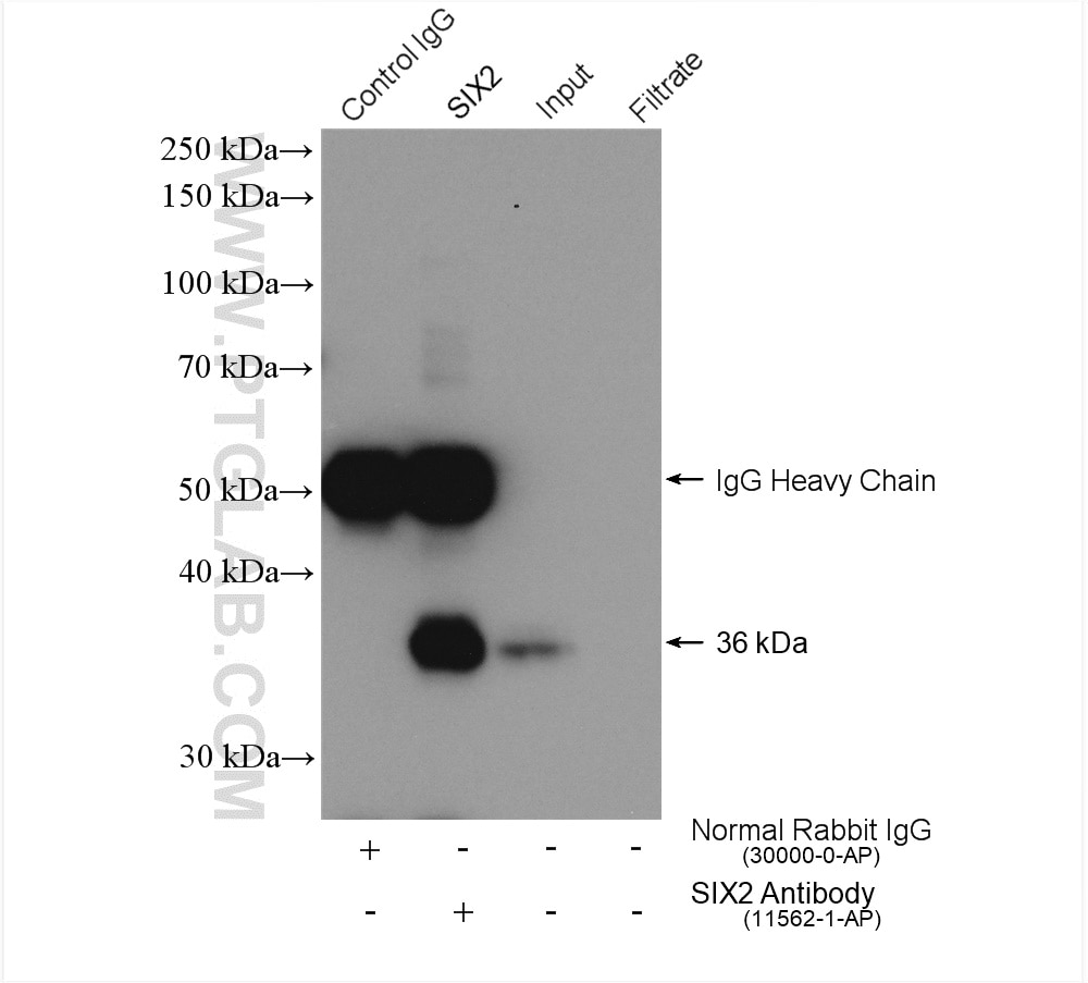 Immunoprecipitation (IP) experiment of HEK-293 cells using SIX2 Polyclonal antibody (11562-1-AP)