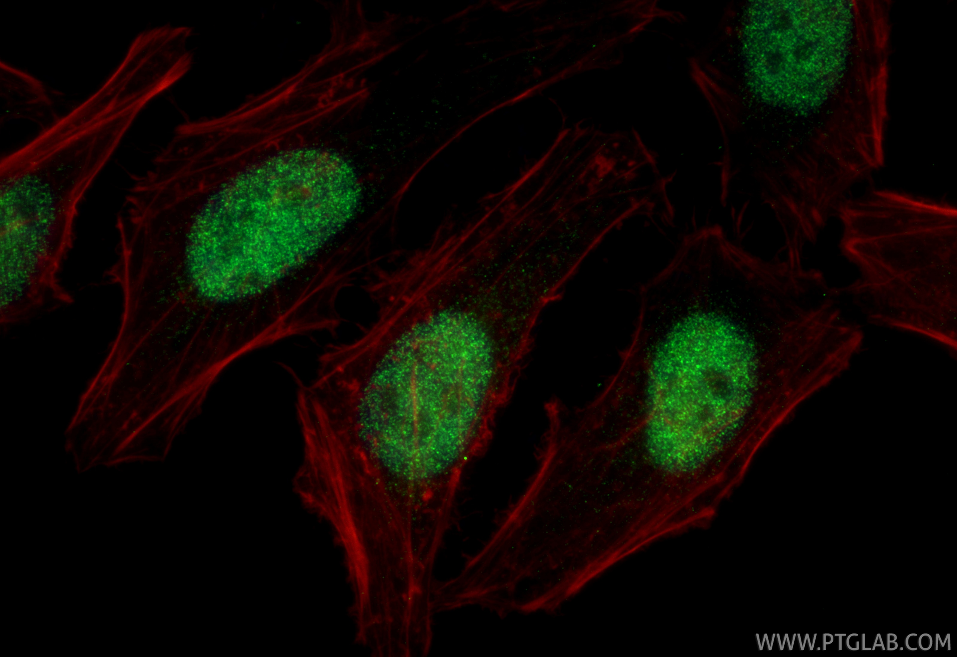 Immunofluorescence (IF) / fluorescent staining of HeLa cells using SIX2 Monoclonal antibody (66347-1-Ig)