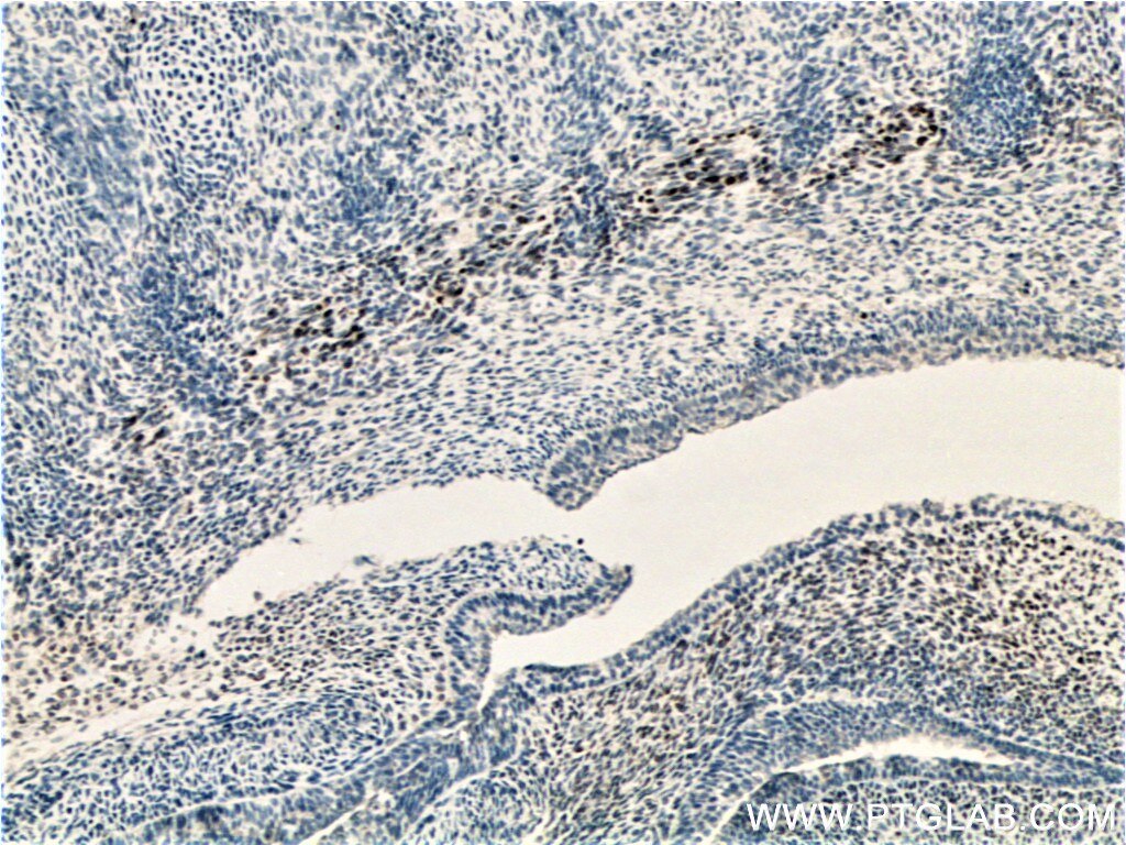 Immunohistochemistry (IHC) staining of mouse embryo tissue using SIX2 Monoclonal antibody (66347-1-Ig)