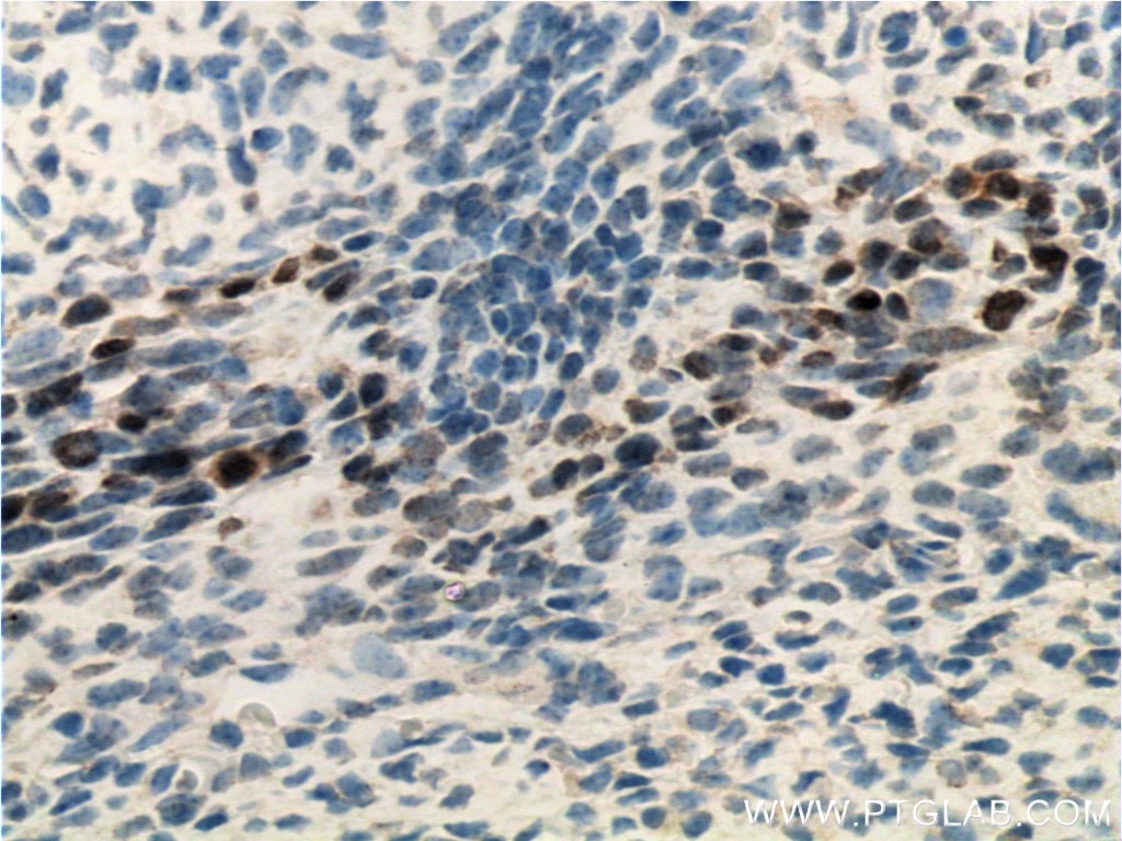 Immunohistochemistry (IHC) staining of mouse embryo tissue using SIX2 Monoclonal antibody (66347-1-Ig)