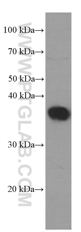 Western Blot (WB) analysis of MDCK cells using SIX2 Monoclonal antibody (66347-1-Ig)