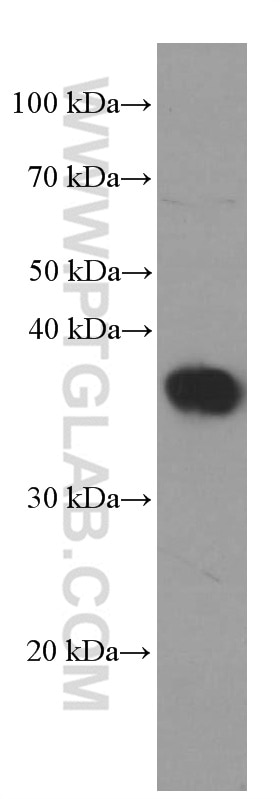 WB analysis of MDCK using 66347-1-Ig