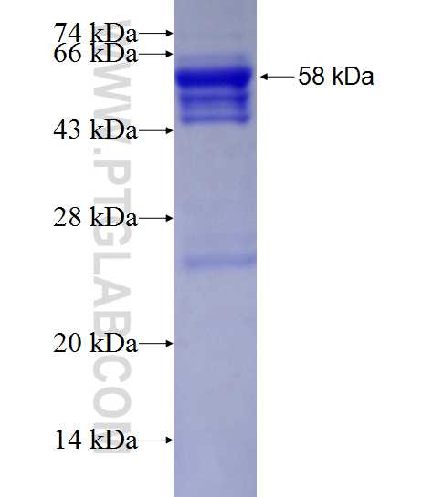 SIX2 fusion protein Ag2124 SDS-PAGE
