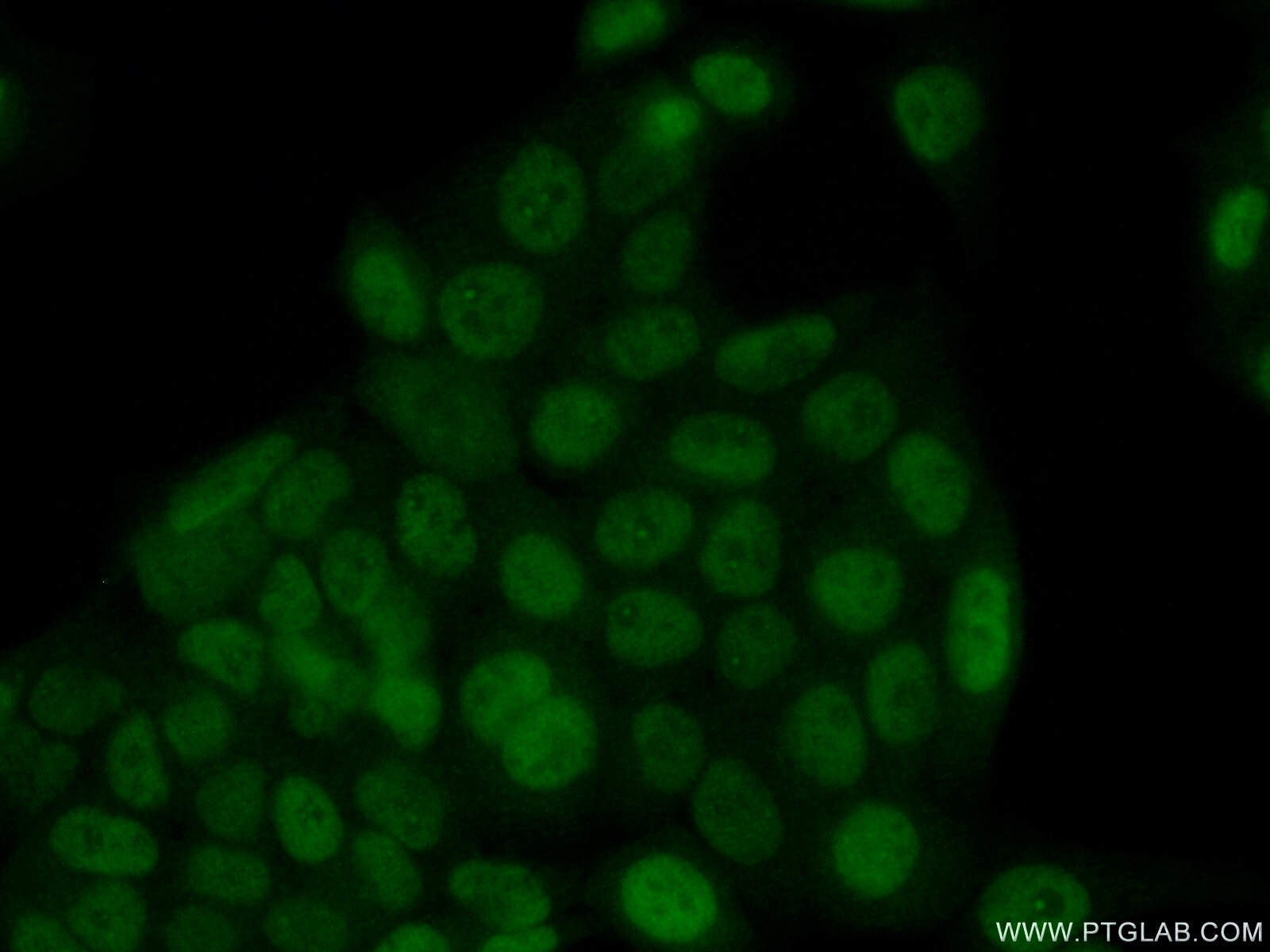 Immunofluorescence (IF) / fluorescent staining of HeLa cells using SIX4 Polyclonal antibody (21305-1-AP)