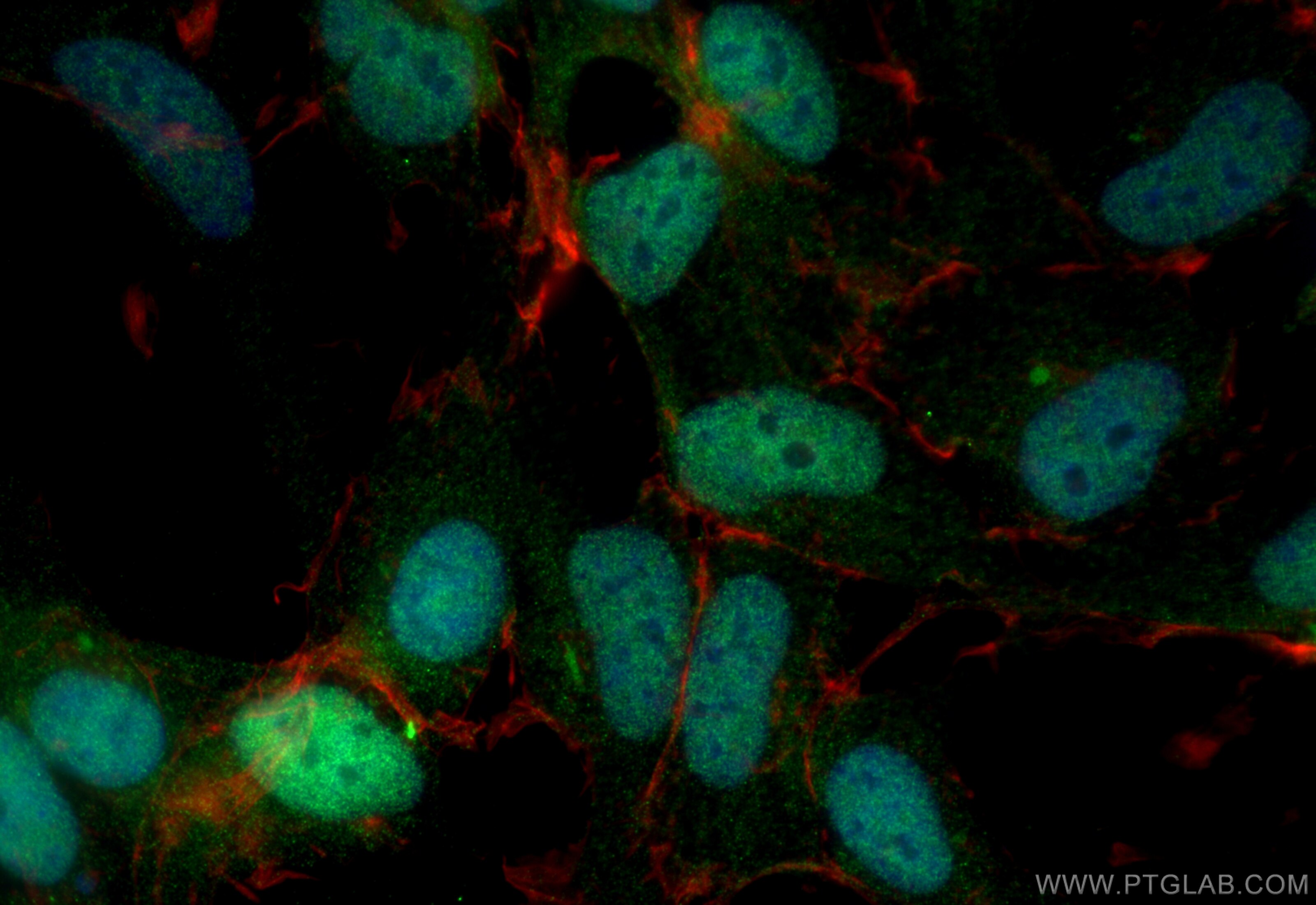 Immunofluorescence (IF) / fluorescent staining of HEK-293 cells using SIX4 Polyclonal antibody (21305-1-AP)