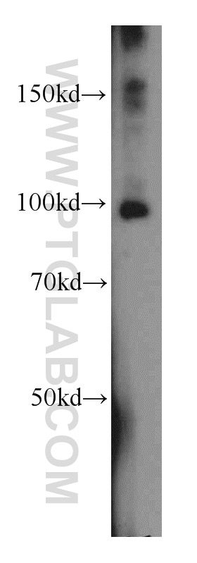 Western Blot (WB) analysis of HeLa cells using SIX4 Polyclonal antibody (21305-1-AP)