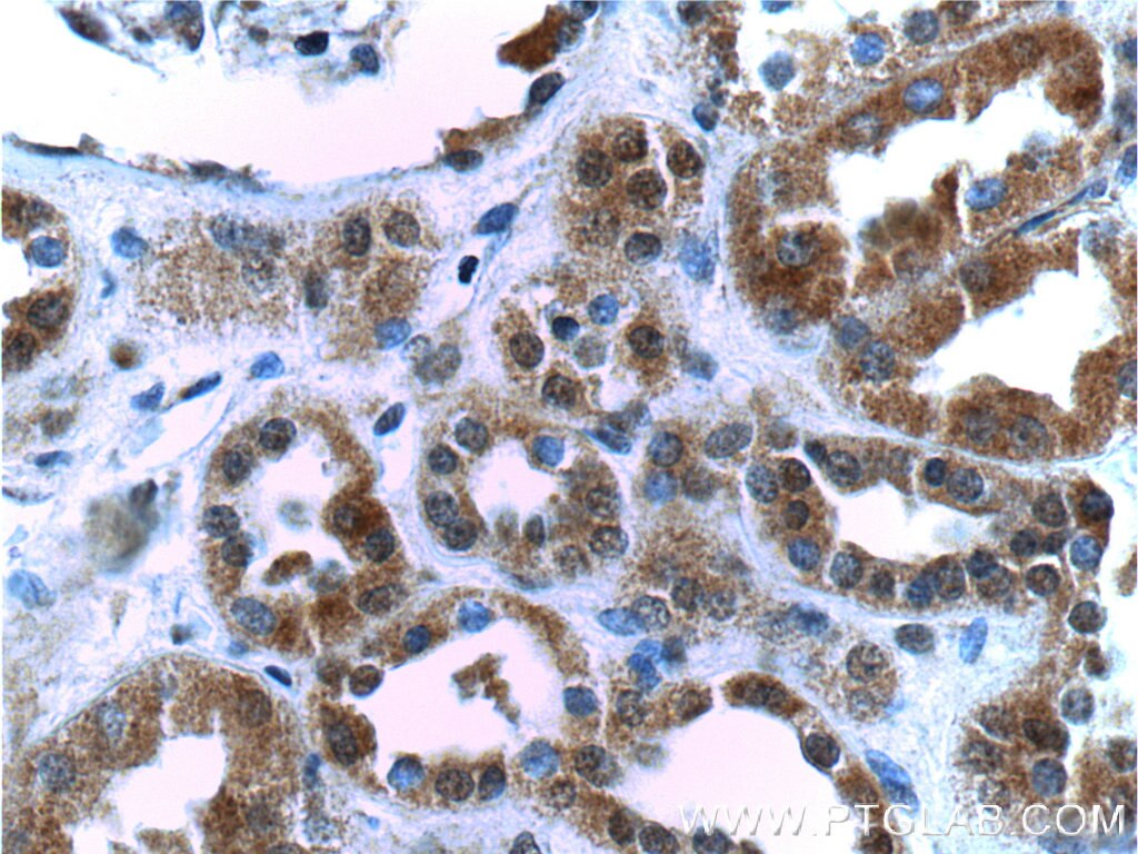 Immunohistochemistry (IHC) staining of human kidney tissue using SIX5 Polyclonal antibody (22938-1-AP)